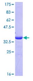 SDS-PAGE (XIAP-226H).jpg